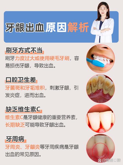 电动牙刷致牙龈萎缩?专家辟谣误区