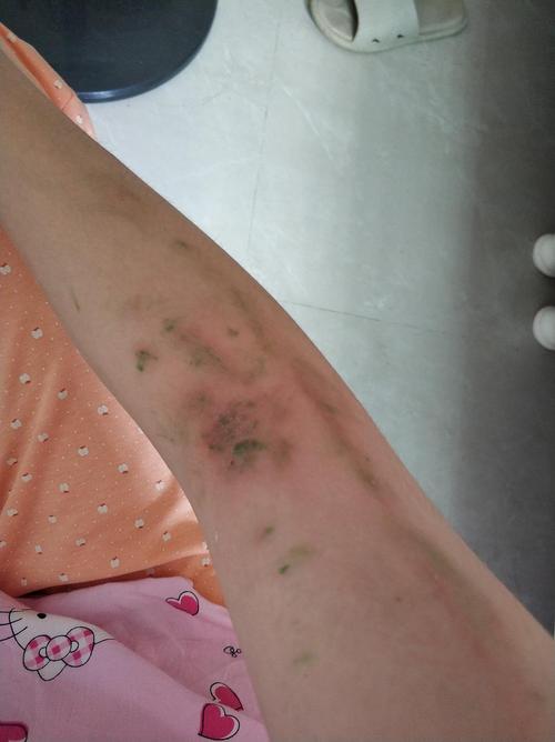 女子加班遇两只隐翅虫桌上缠斗