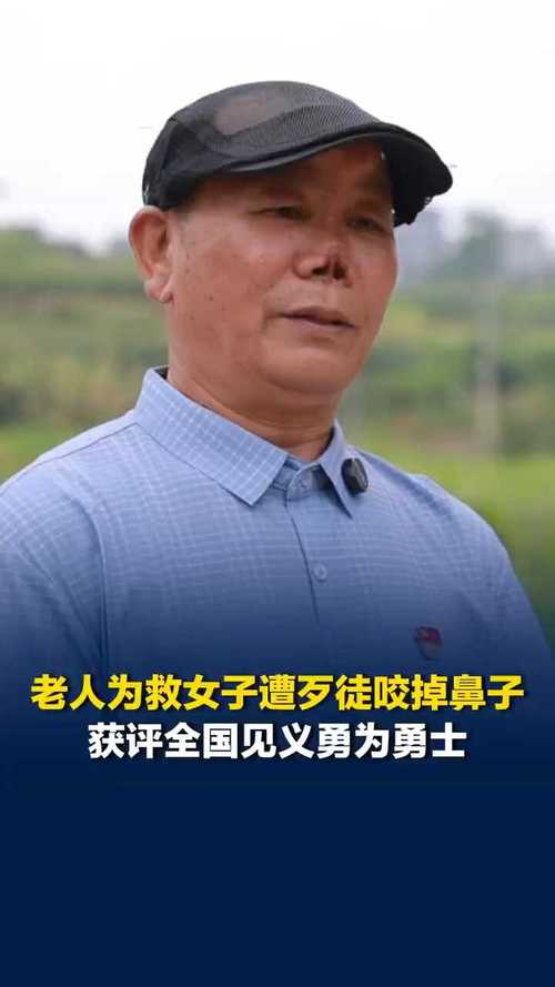 七旬老人救人被咬掉鼻子 获评中国好人